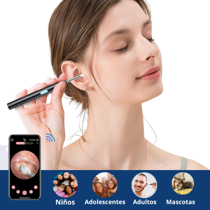 Clowve™ 2.0 Limpieza auditiva con cámara HD
